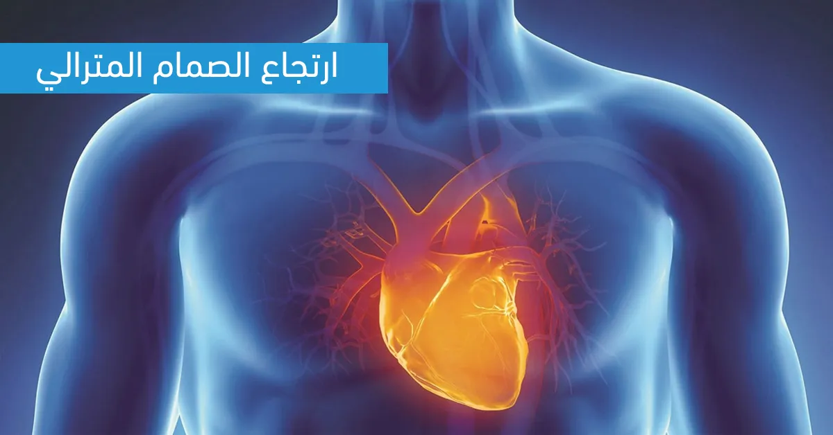 ارتجاع الصمام المترالي